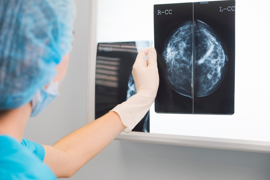 breast health-viewing mammogram